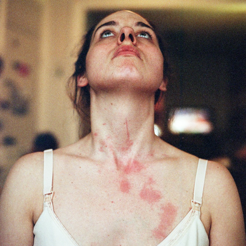 Ogier-Bloomer, Scratches from breastfeeding at nine months, 2014, Archival inkjet print